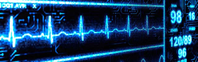monitor corazon