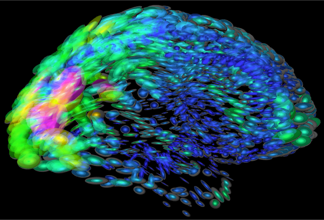 Luz verde para el desarrollo de la plataforma de rehabilitación virtual para enfermos con daño cerebral
