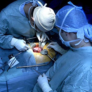 La edad del donante vivo no influye en la tasa de éxito de un trasplante de riñón