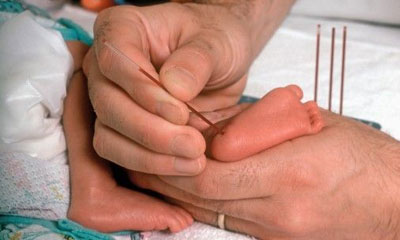La Asociación MPS-Lisosomales reclama incluir el síndrome de Sanfilippo en el cribado neonatal