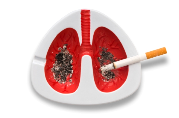El cáncer de pulmón afecta a 15 de cada 100 fumadores