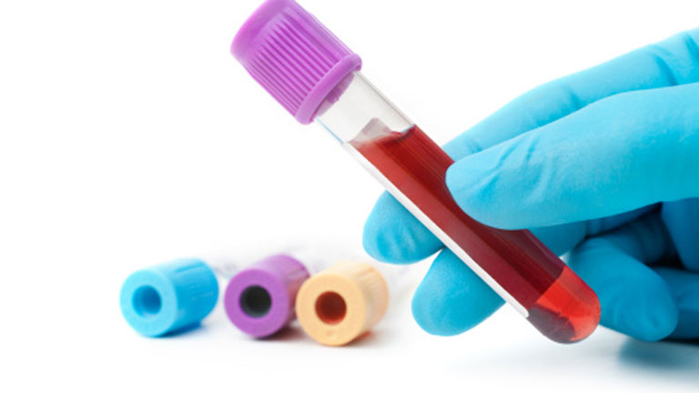 El cáncer de mama podría diagnosticarse precozmente con un análisis de sangre