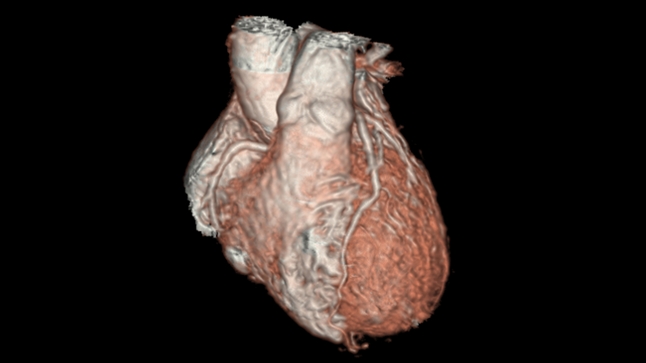 Las enfermedades cardiovasculares en la pandemia