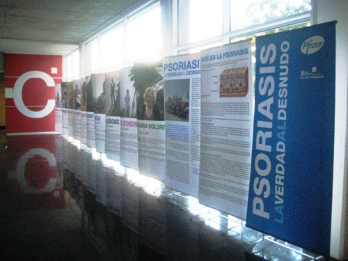 La exposición ‘Psoriasis: la Verdad al Desnudo’, en el Hospital Infanta Leonor