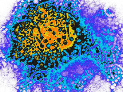 España ocupa el décimo lugar europeo en el cuidado de la hepatitis