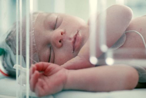 Cada año nacen 15 millones de bebés prematuros