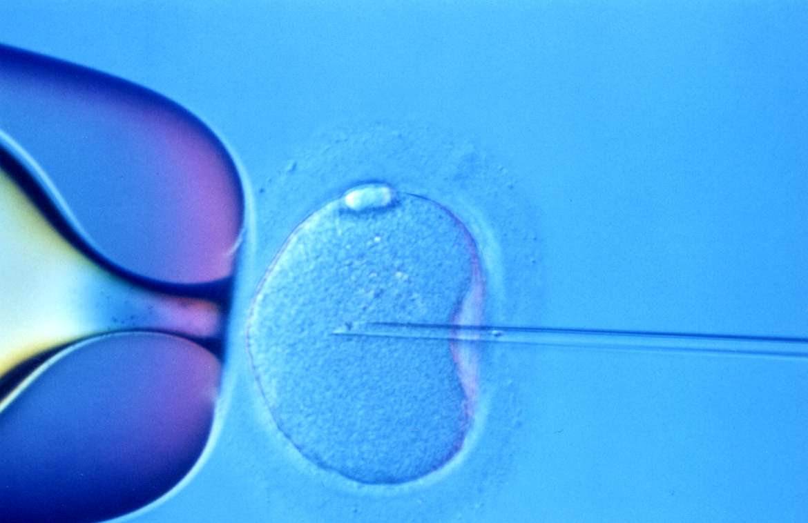La fecundación ‘in vitro’ no aumenta el riesgo de cáncer de mama o de ovario