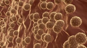 Virus de la hepatitis C
