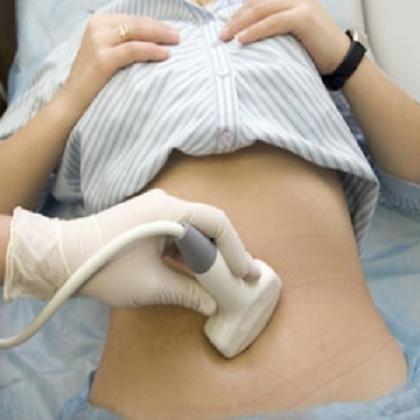 El 45% de pacientes con cáncer de ovario sobrevive a los cinco años del diagnóstico