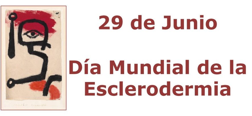 Este sábado se celebra la tercera edición del Día Mundial de la Esclerodermia