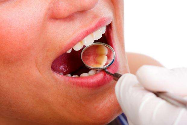 Este miércoles se celebra el Día Europeo contra el Cáncer Oral