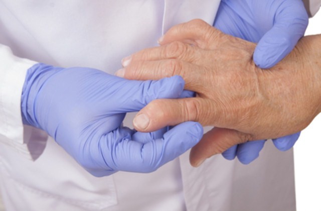 La AR afecta en gran medida a la vida laboral del 95% de los pacientes