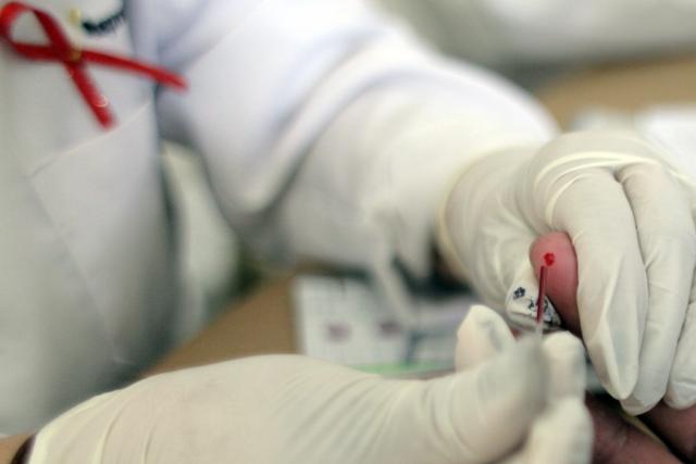 La mitad de los casos de VIH en España se diagnostican de forma tardía