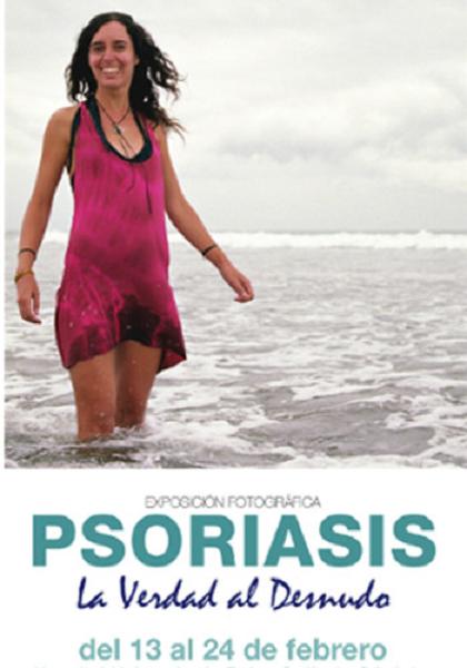 La exposición ‘Psoriasis: la Verdad al Desnudo’ llega a Córdoba