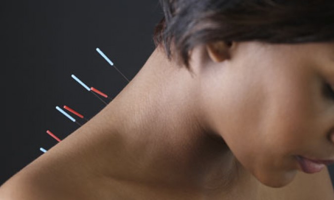 Un estudio muestra que la acupuntura palia los sofocos de la menopausia