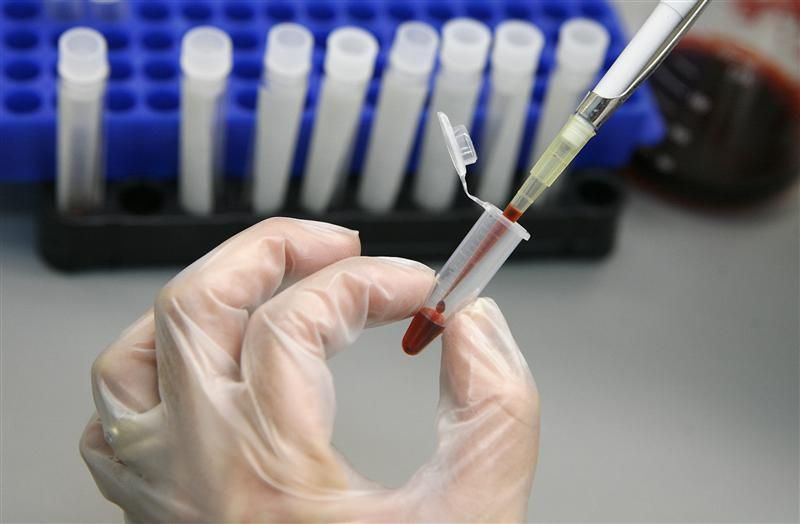 Los nuevos diagnósticos de VIH crecen un 80% en Europa en solo una década