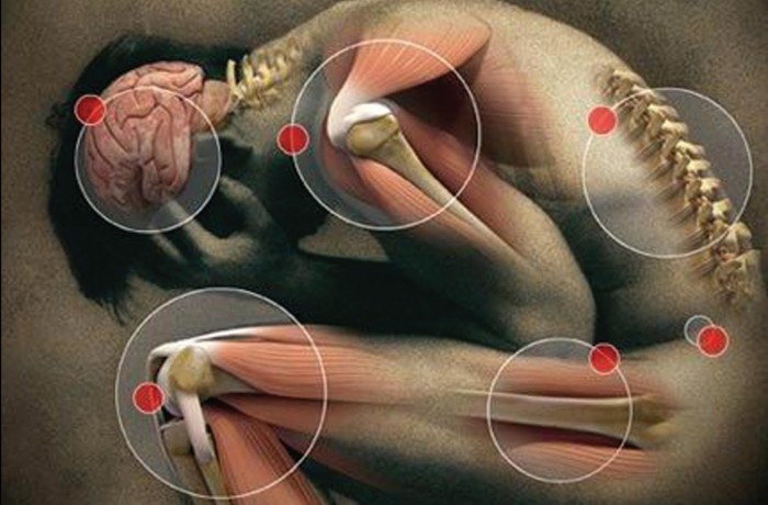 LIRE, ADFM y ConArtritis, ganadoras de las II Ayudas a Asociaciones de la SER