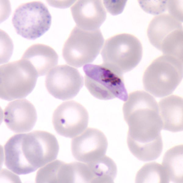 El Nobel premia la investigación en enfermedades parasitarias