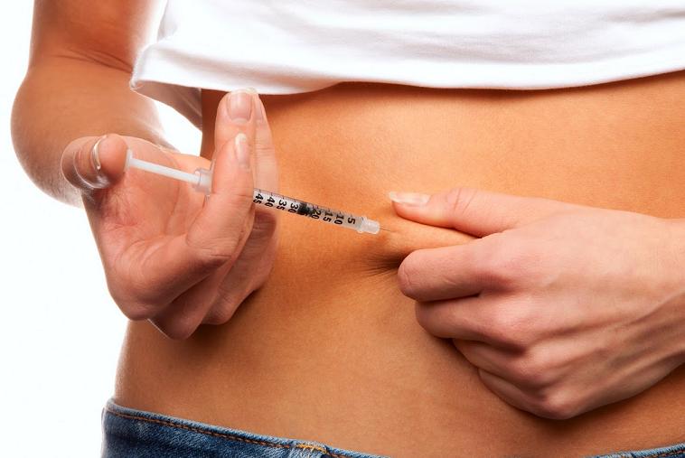 Las bombas de insulina se asocian con menor mortalidad en la diabetes tipo 1