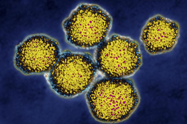 La hepatitis C aumenta en un 30% el riesgo de desarrollar Parkinson