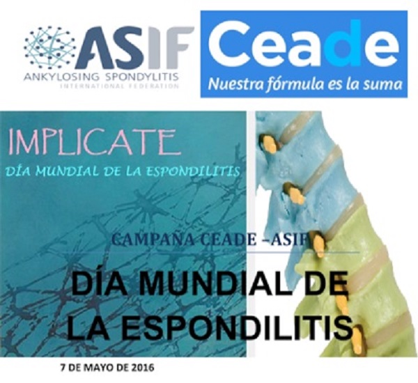 Este sábado se celebra el Día Mundial de la Espondilitis Anquilosante