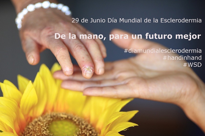 ‘De la mano, por un futuro mejor’ en el Día Mundial de la Esclerodermia