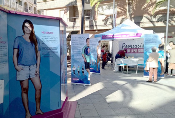 La exposición ‘Psoriasis, lo que la piel esconde’ llega a Castellón