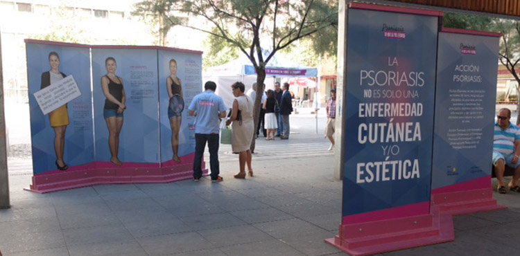 Jornada y exposición ‘Psoriasis, lo que la piel esconde’ en Terrassa
