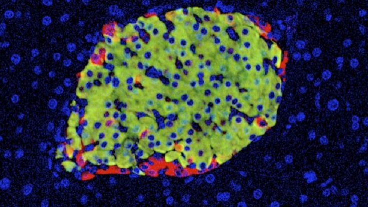La diabetes se origina por el fallo de un escaso número de células pancreáticas
