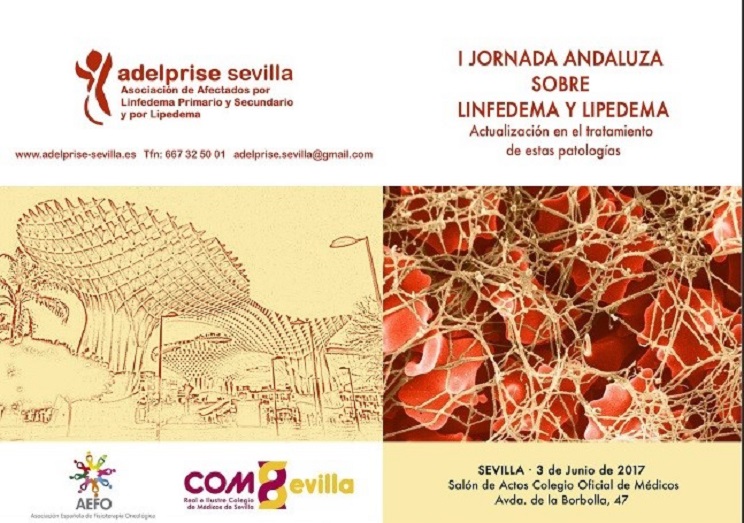 ‘I Jornada Andaluza sobre Linfedema y Lipedema’, el 3 de junio en Sevilla
