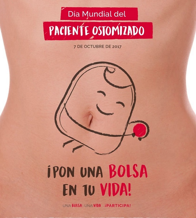 Este sábado, 7 de octubre, se celebra el Día Mundial del Paciente Ostomizado