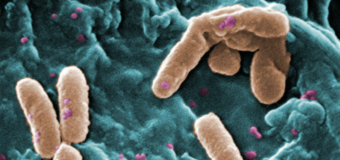 La AMYS alerta del aumento de las infecciones por bacterias multirresistentes