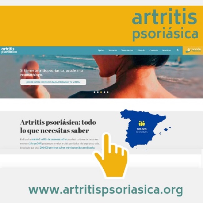 Acción Psoriasis presenta su página web renovada sobre artritis psoriásica