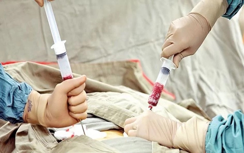 Donación de médula ósea: el reto de sumar  jóvenes para salvar vidas