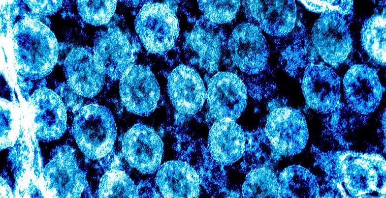 Conocer el impacto del coronavirus en los pacientes crónicos