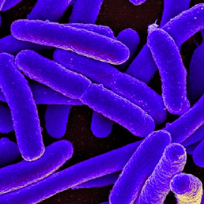 Más muertes por superbacterias que por VIH/sida o malaria