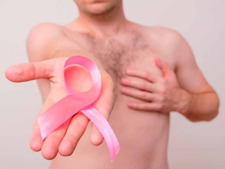 Alianza para la investigación del cáncer de mama en el varón