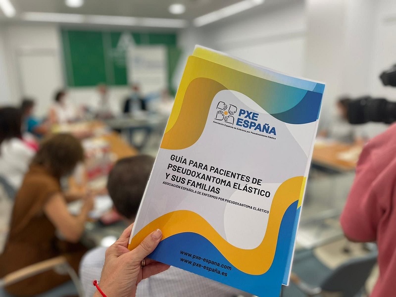 Todo lo que necesitas saber sobre el pseudoxantoma elástico