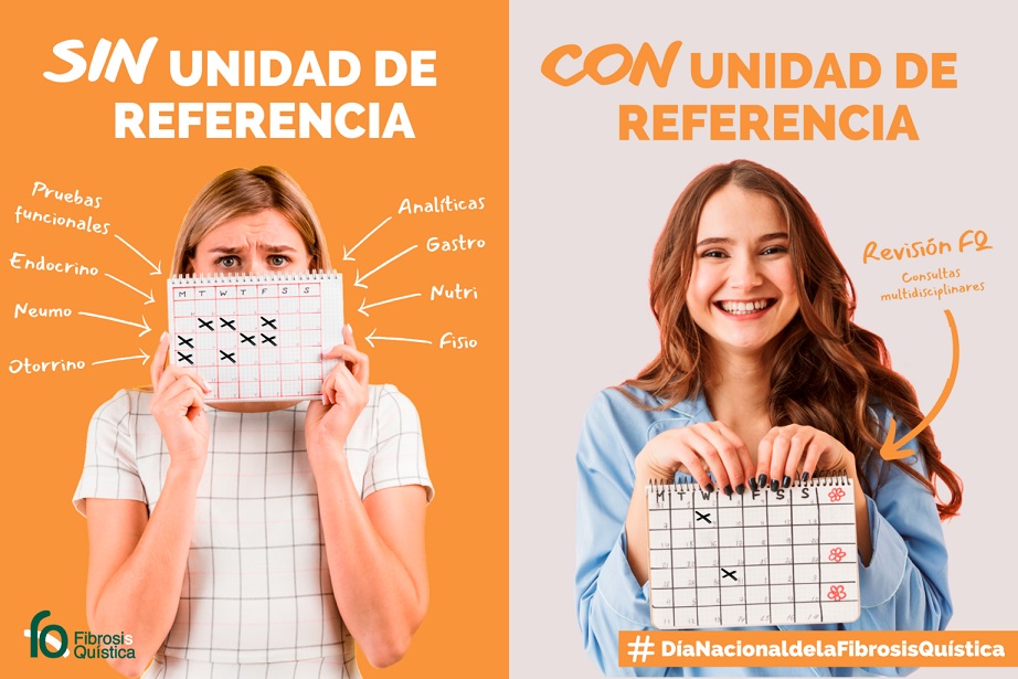 Unidades de referencia para un mejor abordaje de la fibrosis quística