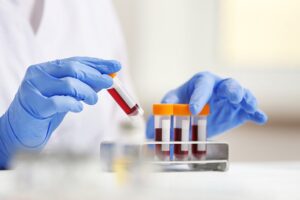 Un nuevo método podría reducir el tiempo de diagnóstico de la sepsis de días a horas