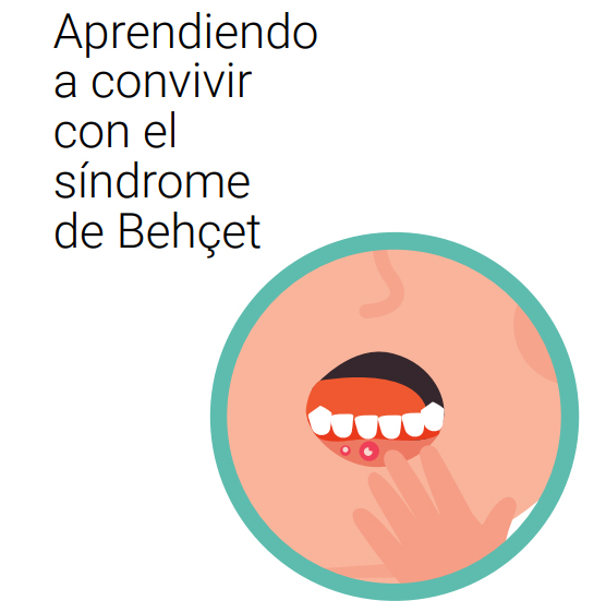La SER publica un documento para el manejo del Síndrome de Behçet