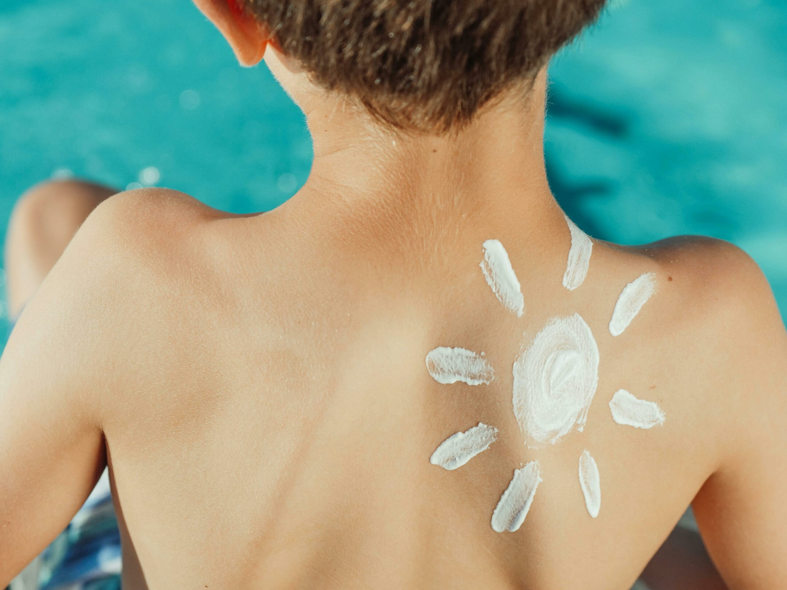 Melanoma: casi 8.000 nuevos casos en España durante 2024