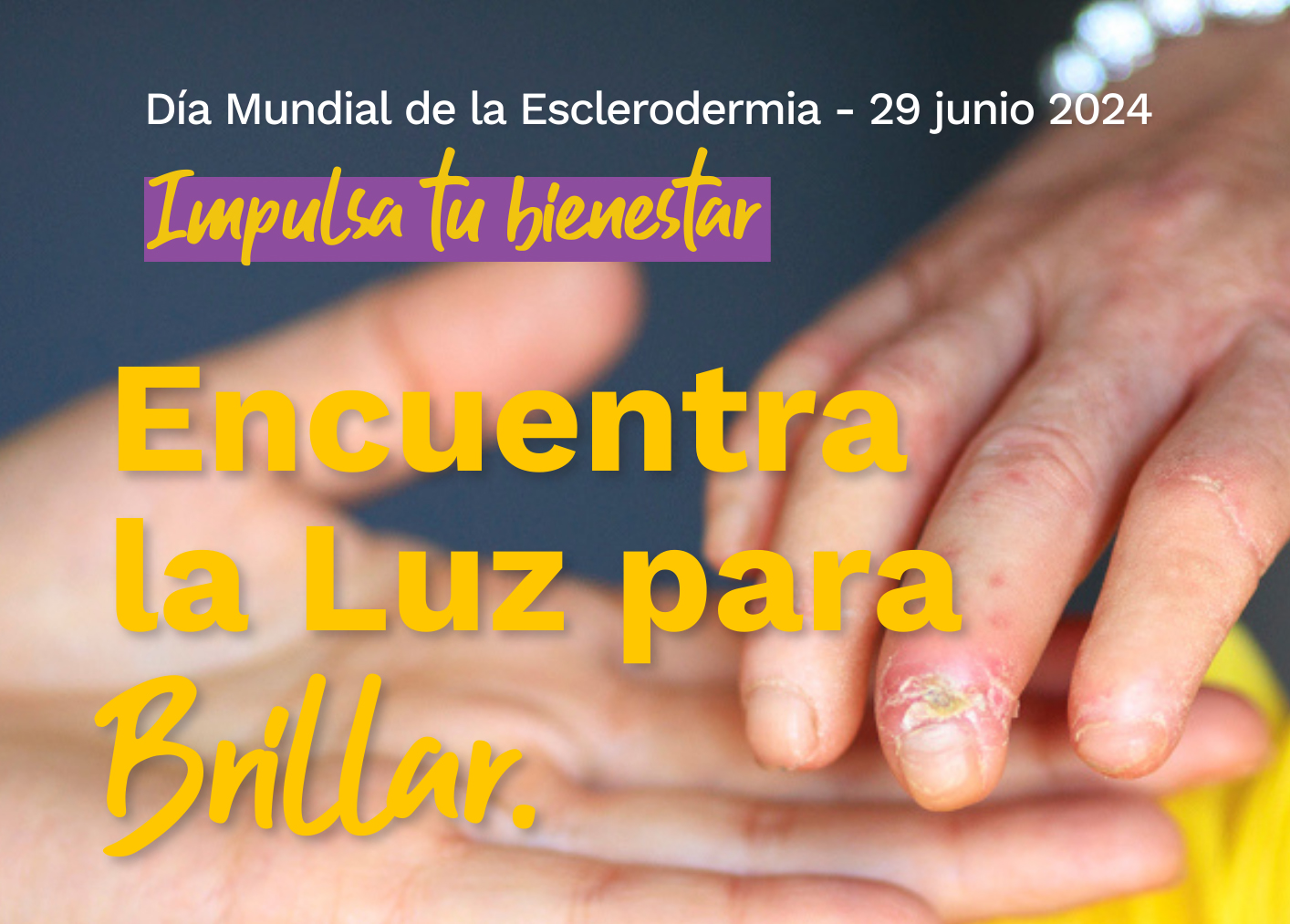 Día Mundial de la Esclerodermia: una jornada cargada de actividades para concienciar