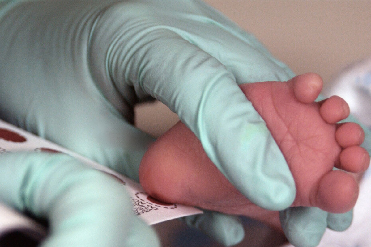 FundAME pide que se incluya urgentemente la atrofia muscular espinal en el cribado neonatal