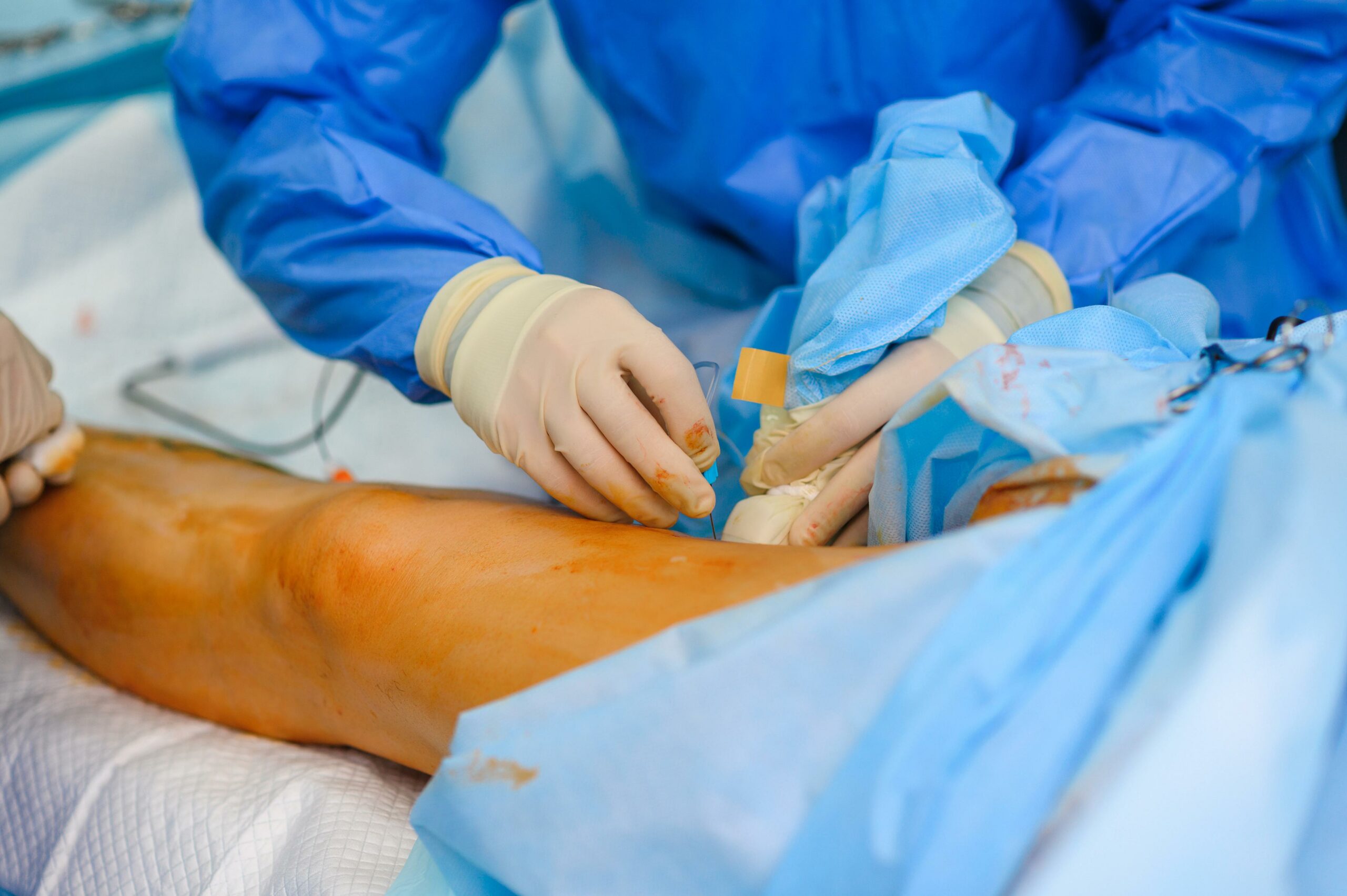 Día Mundial de la Trombosis: concienciación sobre la tercera causa de muerte cardiovascular