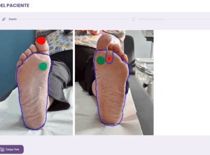 Una app con visión artificial facilita el diagnóstico y seguimiento del pie diabético desde Atención Primaria