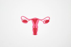 El síndrome de ovario poliquístico afecta entre un 5% y un 26% de las mujeres