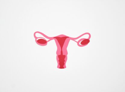 El síndrome de ovario poliquístico afecta entre un 5% y un 26% de las mujeres