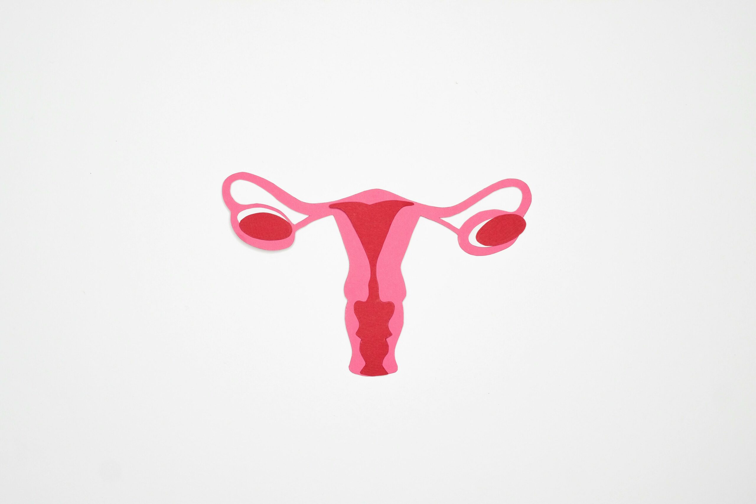 El síndrome de ovario poliquístico afecta entre un 5% y un 26% de las mujeres